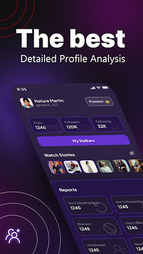 Follower Tracker Stalk Report ekran görüntüsü