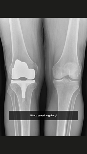 X-Ray Kamera Arkadaş Şaka ekran görüntüsü
