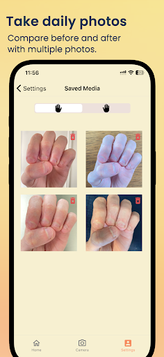 NailKeeper - Stop Biting Nails ekran görüntüsü