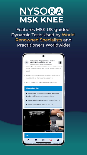 NYSORA MSK US Knee App ekran görüntüsü