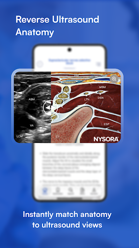 NYSORA Nerve Blocks ekran görüntüsü