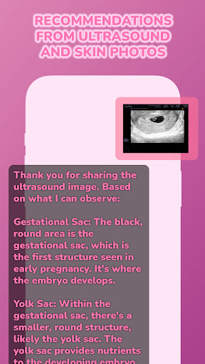 AI Pregnancy Tracking App ekran görüntüsü