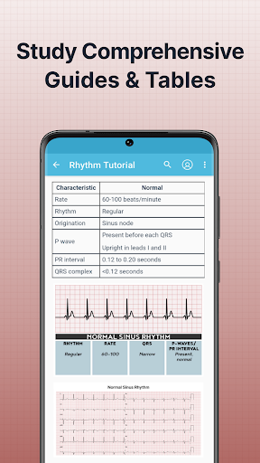 ECG EKG Interpretation Mastery ekran görüntüsü