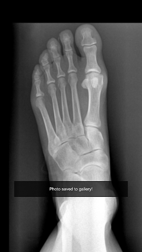 X-Ray Kamera Arkadaş Şaka ekran görüntüsü