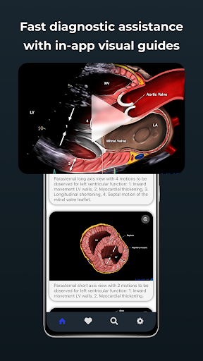 Point of Care Ultrasound ekran görüntüsü
