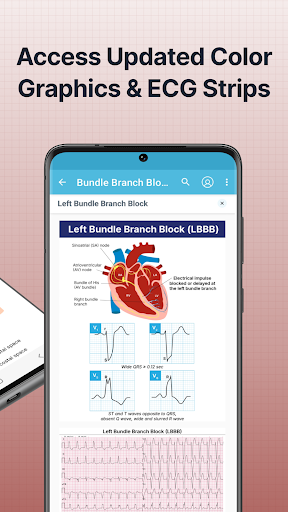 ECG EKG Interpretation Mastery ekran görüntüsü