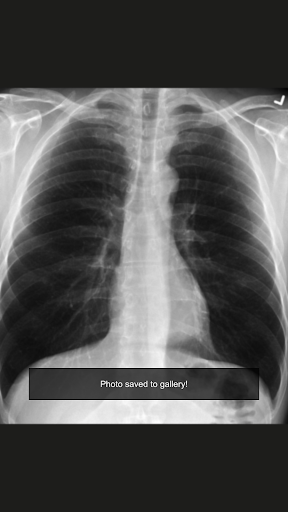 X-Ray Kamera Arkadaş Şaka ekran görüntüsü