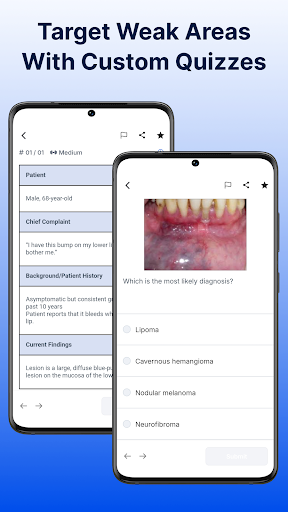 Dental Boards Mastery: INBDE ekran görüntüsü