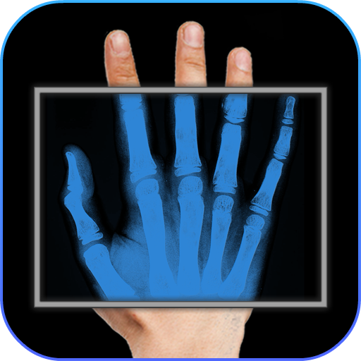 X-Ray Kamera Arkadaş Şaka