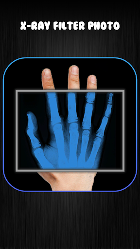 X-Ray Kamera Arkadaş Şaka ekran görüntüsü