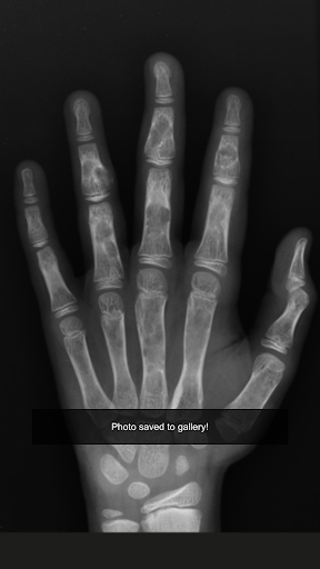 X-Ray Kamera Arkadaş Şaka ekran görüntüsü