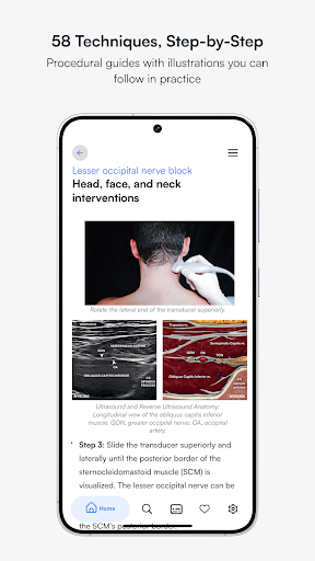 Ultrasound Pain ekran görüntüsü