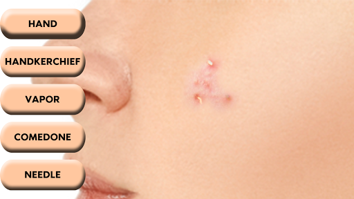 Pimple Popper ekran görüntüsü