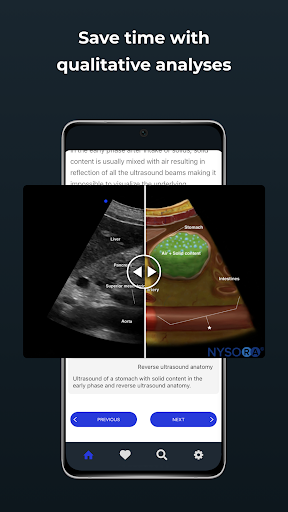 Point of Care Ultrasound ekran görüntüsü