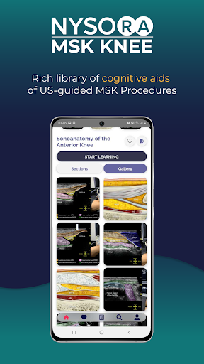 NYSORA MSK US Knee App ekran görüntüsü