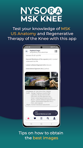 NYSORA MSK US Knee App ekran görüntüsü