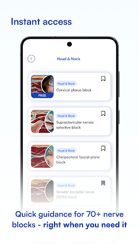 NYSORA Nerve Blocks ekran görüntüsü