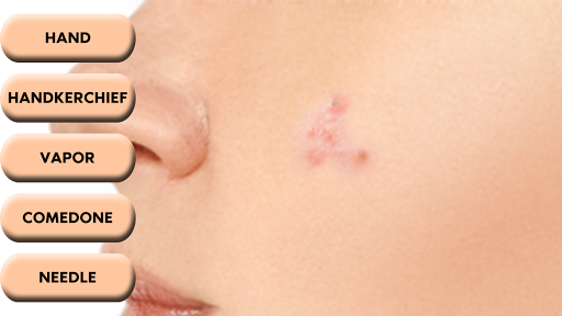 Pimple Popper ekran görüntüsü