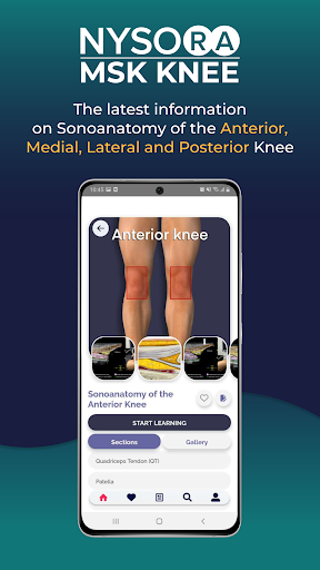 NYSORA MSK US Knee App ekran görüntüsü