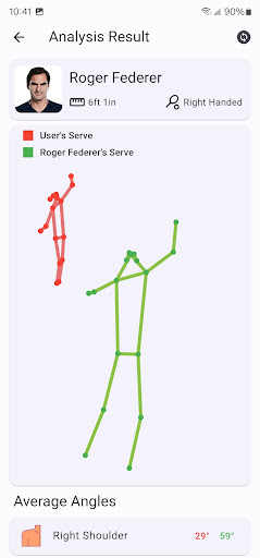 Serve Analyzer ekran görüntüsü