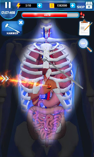 Cerrahi Ustası - Surgery Maste ekran görüntüsü