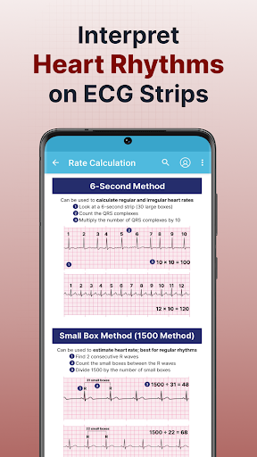 ECG EKG Interpretation Mastery ekran görüntüsü